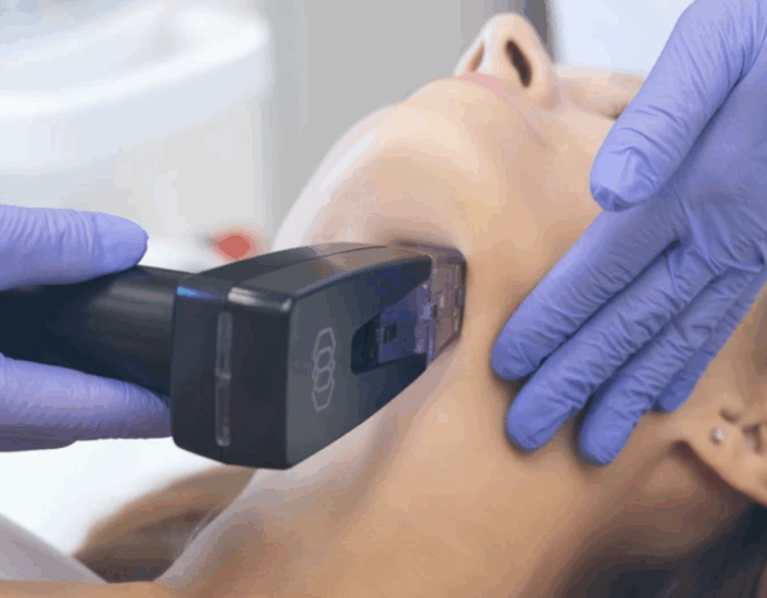 How to Find the Best Morpheus8 Specialist Cosmetic Surgeon in Sydney